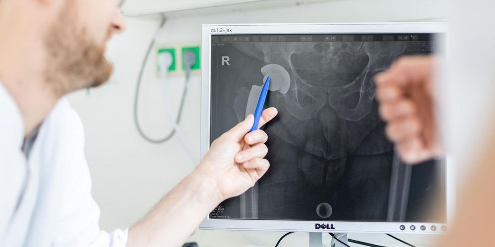 Ein Arzt erklärt die Behandlung des Hüftgelenks in der Spezialsprechstunde der orthopädischen Ambulanz. 
