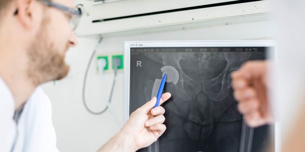 Bild eines Beckens auf einem Computerbildschirm. Ein Arzt zeigt mit einem Stift etwas auf diesem. 